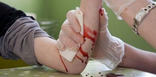 How To Stop Excessive Bleeding In A Survival Situation